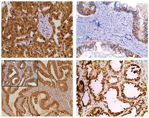 Figure from article: Prognostic significance of...
