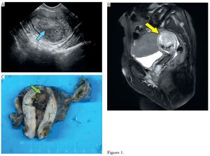 Figure from article: Quiz what is your diagnosis?