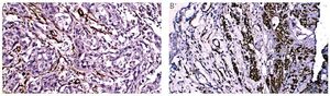 Figure from article: The clinicopathological...