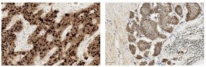 Figure from article: Pumilio2, but not Pumilio1,...