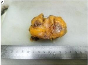 Figure from article: Clinical and pathological...