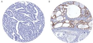 Figure from article: Using large-scale tissue...