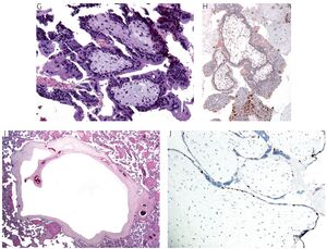 Figure from article: Immunohistochemistry in...