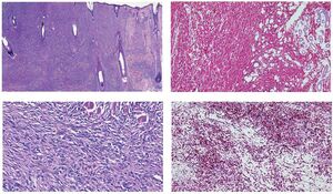 Figure from article: Immunohistochemistry in...