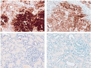 Figure from article: Review of a Decade of IHC...