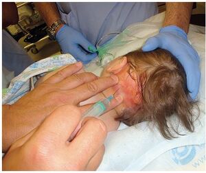 Figure from article: Ancillary tests in...