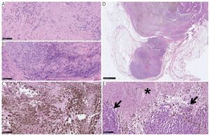 Figure from article: Pathologic assessment of...
