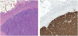 Figure from article: Immunohistochemical and...