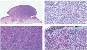 Figure from article: Pitfalls in the diagnosis...